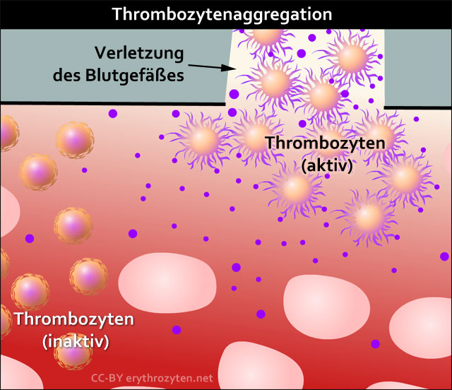 Thrombozytenaggregation: Wunde in einem Blutgefäß wird zügig geschlossen